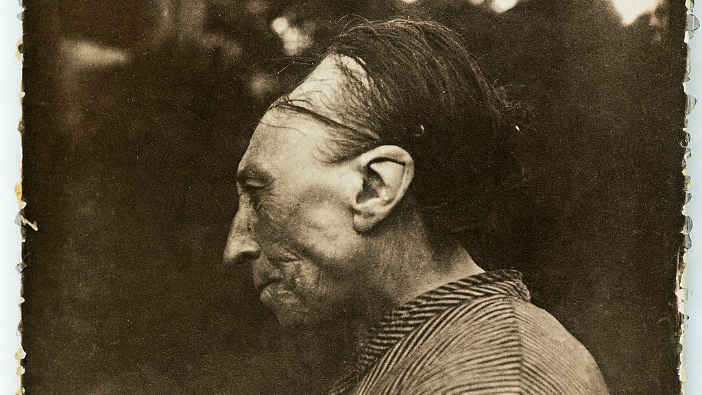 Head shaping, or "bandeau,"